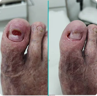 caso 5